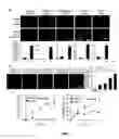 Fig. 08 - Compositions and Methods for Treating and/or Preventing Cancer by Inhibiting Fatty Acid Binding Proteins