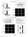Fig. 09 - Compositions and Methods for Treating and/or Preventing Cancer by Inhibiting Fatty Acid Binding Proteins