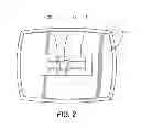 Fig. 03 - Unity heart device