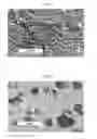 Fig. 02 - Separator for non-aqueous secondary battery, method for producing the same, and non-aqueous secondary battery