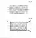 Fig. 04 - Amorphous metal current collector