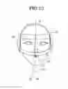 Fig. 09 - OCCLUSION CORRECTION IMPROVEMENT INSTRUMENT AND CORRECTION IMPROVEMENT METHOD USING THE INSTRUMENT