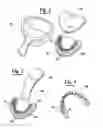 Fig. 02 - METHOD FOR MAKING AN IMPRESSION TRAY FOR DENTAL USE