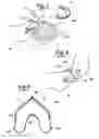 Fig. 04 - METHOD FOR MAKING AN IMPRESSION TRAY FOR DENTAL USE