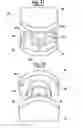 Fig. 09 - METHOD FOR MAKING AN IMPRESSION TRAY FOR DENTAL USE