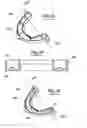 Fig. 10 - METHOD FOR MAKING AN IMPRESSION TRAY FOR DENTAL USE