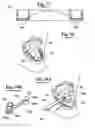 Fig. 11 - METHOD FOR MAKING AN IMPRESSION TRAY FOR DENTAL USE