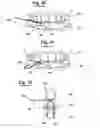 Fig. 12 - METHOD FOR MAKING AN IMPRESSION TRAY FOR DENTAL USE
