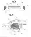 Fig. 15 - METHOD FOR MAKING AN IMPRESSION TRAY FOR DENTAL USE