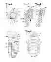 Fig. 03 - Expandable dental implant and method of use