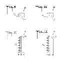Fig. 04 - Expandable dental implant and method of use