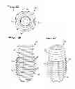 Fig. 09 - Expandable dental implant and method of use