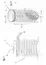 Fig. 05 - Endosseous implant of the improved type