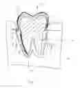 Fig. 03 - Implantable replica of natural tooth