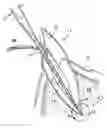 Fig. 01 - Apparatus for evacuation of root canal