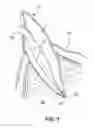 Fig. 02 - Apparatus for evacuation of root canal