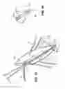 Fig. 04 - Apparatus for evacuation of root canal