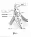 Fig. 06 - Apparatus for evacuation of root canal