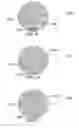 Fig. 30 - Method and system for quantitative assessment of word recognition sensitivity