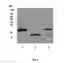 Fig. 02 - EGFR and PAR2 Regulation of Intestinal Permeability