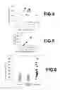 Fig. 04 - MOLECULAR MARKER FOR THE EARLY DETECTION OF MALIGNANT PLEURAL MESOTHELIOMA AND THE METHODS OF ITS EXPRESSION ANALYSIS USING BLOOD AND PLEURAL EFFUSION SAMPLES