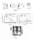 Fig. 14 - Affinity-based detection of ligand-encoded synthetic biomarkers