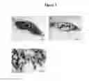 Fig. 04 - PROCESS FOR OBTAINING COPPER NANOPARTICLES FROM A FUNGUS SELECTED BETWEEN HYPOCREA LIXII AND TRICHODERMA KONINGIOPSIS AND USE OF FUNGI SELECTED BETWEEN HYPOCREA LIXII AND TRICHODERMA KONINGIOPSIS IN BIOREMEDIATION OF WASTEWATER AND PRODUCTION OF COPPER NANOPARTICLES