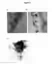 Fig. 10 - PROCESS FOR OBTAINING COPPER NANOPARTICLES FROM A FUNGUS SELECTED BETWEEN HYPOCREA LIXII AND TRICHODERMA KONINGIOPSIS AND USE OF FUNGI SELECTED BETWEEN HYPOCREA LIXII AND TRICHODERMA KONINGIOPSIS IN BIOREMEDIATION OF WASTEWATER AND PRODUCTION OF COPPER NANOPARTICLES