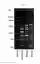 Fig. 02 - Lactic acid bacterium having IgA production promoting activity, and use thereof