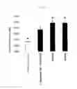 Fig. 03 - Lactic acid bacterium having IgA production promoting activity, and use thereof