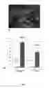 Fig. 04 - Method for preparing induced paraxial mesoderm progenitor (IPAM) cells and their use