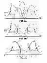 Fig. 03 - PUMPING/NURSING BRA