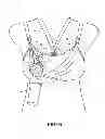 Fig. 07 - PUMPING/NURSING BRA