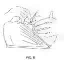 Fig. 09 - PUMPING/NURSING BRA