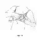 Fig. 11 - PUMPING/NURSING BRA