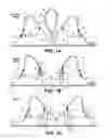 Fig. 02 - Pumping/nursing bra