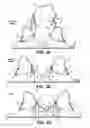 Fig. 04 - Pumping/nursing bra