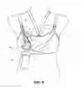 Fig. 07 - Pumping/nursing bra