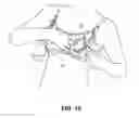 Fig. 11 - Pumping/nursing bra