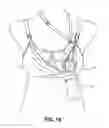 Fig. 19 - Pumping/nursing bra