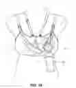 Fig. 20 - Pumping/nursing bra