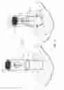 Fig. 06 - Vent sealing device and system