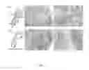 Fig. 02 - METHOD OF TREATING DERMATOLOGICAL DISORDERS