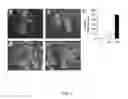 Fig. 04 - METHOD OF TREATING DERMATOLOGICAL DISORDERS