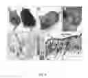 Fig. 07 - METHOD OF TREATING DERMATOLOGICAL DISORDERS