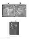 Fig. 02 - BRTCP24 gene useful for controlling growth of cabbage and application thereof