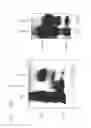 Fig. 16 - PSCA: PROSTATE STEM CELL ANTIGEN AND USES THEREOF