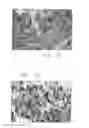 Fig. 31 - PSCA: PROSTATE STEM CELL ANTIGEN AND USES THEREOF