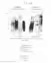 Fig. 61 - PSCA: PROSTATE STEM CELL ANTIGEN AND USES THEREOF
