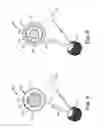 Fig. 09 - Artificial urinary sphincter having a multi-compartment cuff